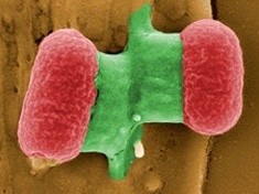 SANEPID informuje, jak ustrzec się przed E. coli O104